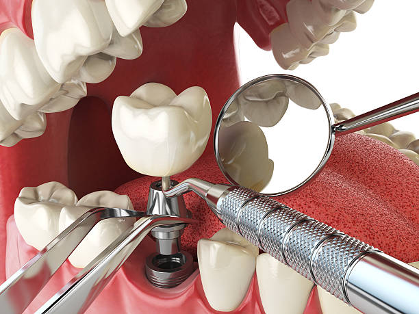 Best Emergency Root Canal Treatment in Van Horn, TX